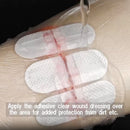 SmartKit® Zip Stitch Laceration Wound Closure Kit - 31 pcs Bangkok First Aid